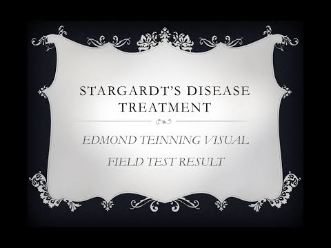 Stargardt Disease Treatment ( Visual Field Test ) - FIRATLI CLINIC