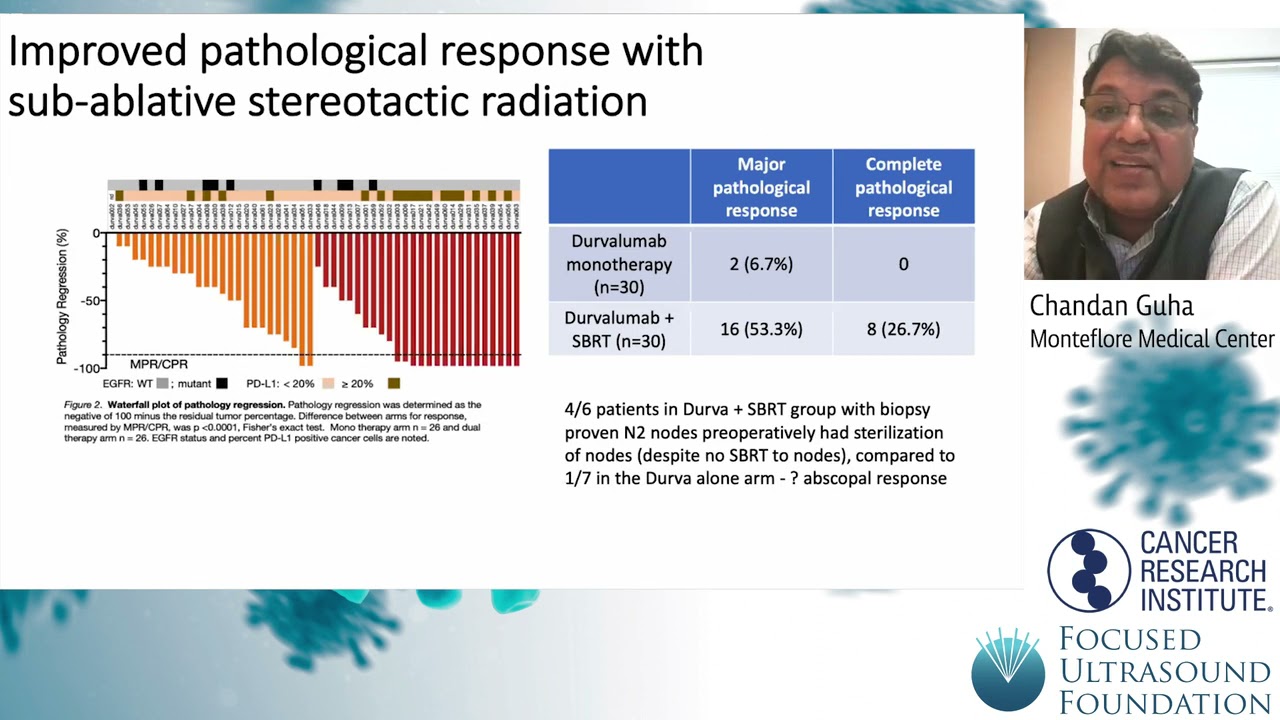 Cancer Immunotherapy Workshop 2021 – Overview of Radiotherapy's Effect on the Immune Response