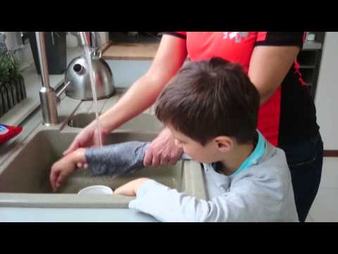 Domowy Ratownik - odc.1 - oparzenie lekkie