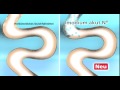 Imodium ADD