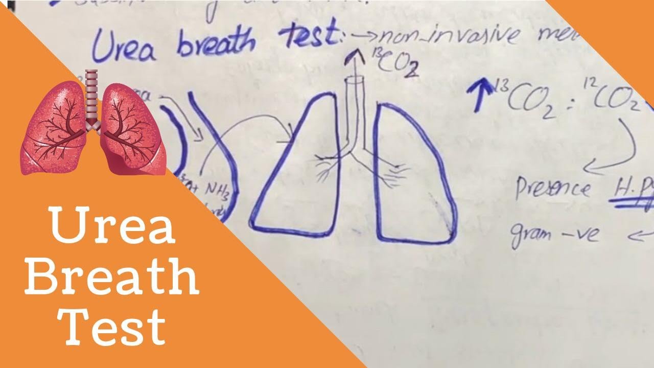 Urea Breath Test - Helicobacter pylori - Infectious Peptic Ulcer. - YouTube