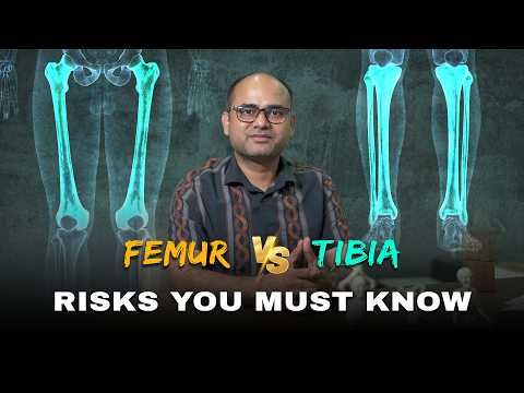 Femur vs Tibia Lengthening | Risks You MUST Know Before Surgery