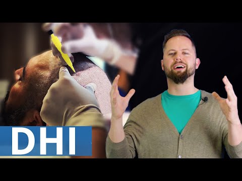DHI vs FUE Haartransplantation! (Vor- und Nachteile)