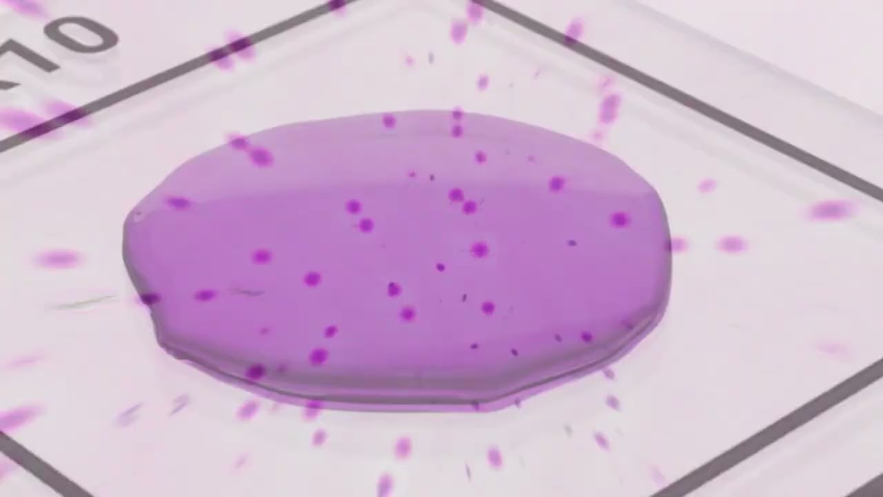 LensHooke X12 PRO Clinical Implementation