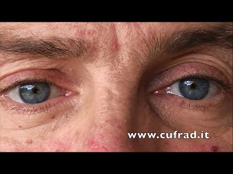 Servizi di Novosibirsk in alcolismo Colm per comprare Nizhniy Novgorod