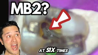 They WON'T show this TIP in Dental SCHOOL {MB2}