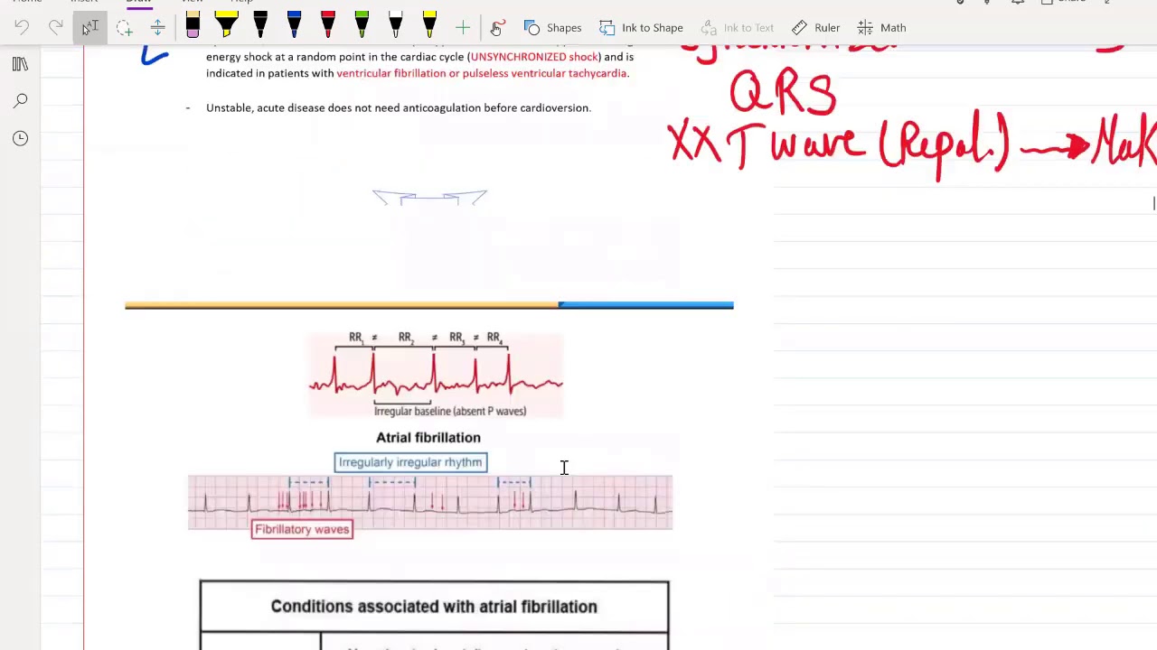 Management of Arrhythmia for USMLE Step 2 CK - (Free trial course in Description Below)