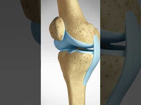 ACL Anterior Cruciate Ligament MCL Medial Collateral Ligament Tear and Repair No Narration