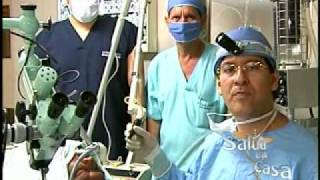 Cirugía de Pólipo en Cuerdas Vocales con Láser