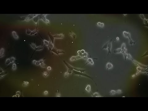 Andrew Oberst discusses research on brain-invading viruses