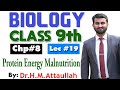Protein energy malnutrition | PEM | Chapter 8 | 9th class Biology | Lec 19