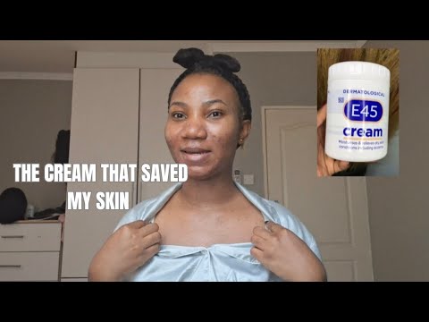 E45 Cream Really Helped My Acne | My Real Experience | Best sunscreen that won't leave white cast 