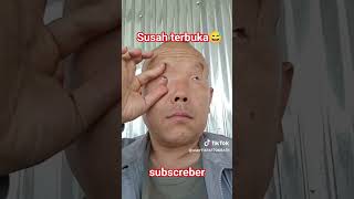 Download lagu bola mata manusia paling kecil didunia #viralvideo #trending #mata #kecil #susak #fyp mp3