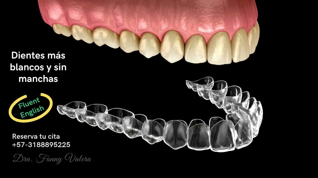 Fanny Valera Velásquez-127