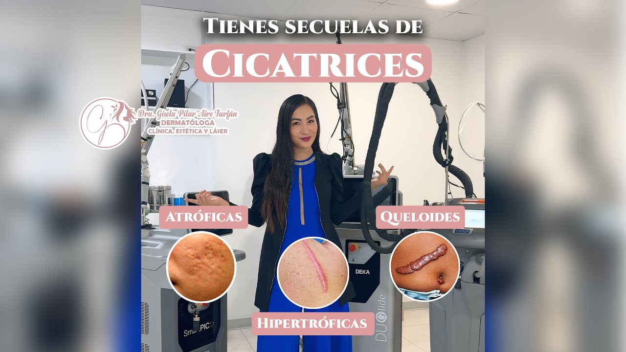 ✨¡Dile ADIÓS a esas CICATRICES con LÁSER, la mejor tecnología para tu PIEL!✨-Dra. Gisela Aire Farfán