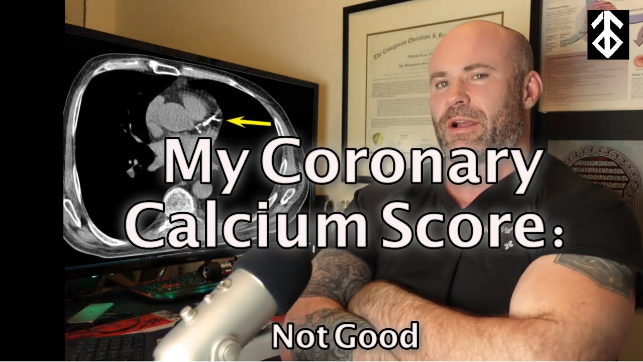 My Coronary Artery Calcium Score and what I'm doing about it.