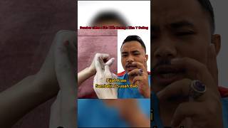 Download lagu 1 Acupressure Point to Relieve Constipation mp3