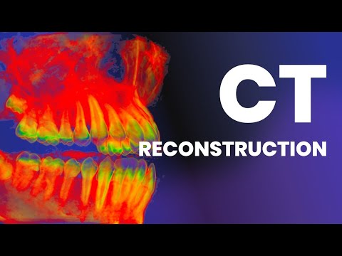 ICT Reconstruction
