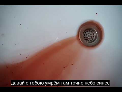 Video thumbnail for Разбитые Коленки (Broken Knees)