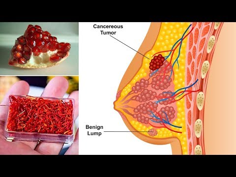 Transurethrale Chirurgie für Prostata-Adenom Ultraschall-Prostata Medical Center