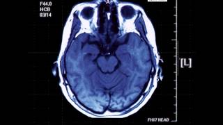 King Dingeling - 01 - Intro (2014) (Track 1)