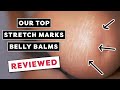 Top 5 Belly Balms For Pregnancy Stretch Marks Itching Tried Tested