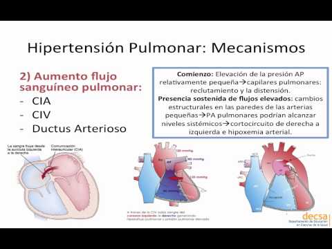 Hipertensión arterial mjekimi i hipertensionit Hipertensión arterial mjekimi i hipertensionit