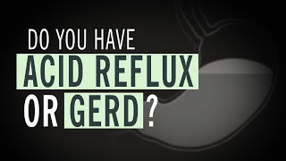 Do You Have Acid Reflux or GERD?