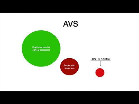 Why you shouldn't do the HINTS exam on patients who DON'T have nystagmus