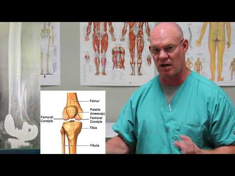 Distal Femur Fracture | Fracture Friday Episode 15