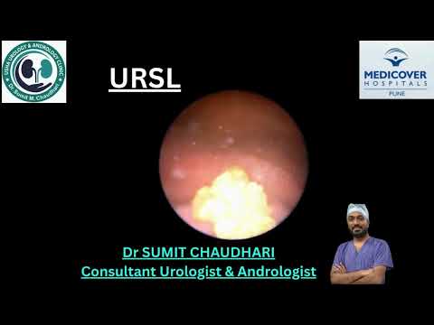 URSL( Ureteroscopic Lithotripsy) | Dr. Sumit Chaudhari 