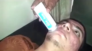 Dr Ice treatment for Acne (Dr Bhutada)