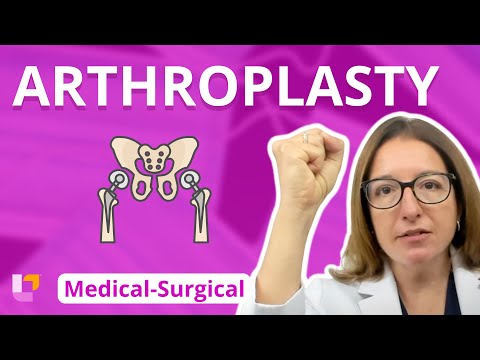 Arthroplasty - Medical-Surgical - Musculoskeletal System | @LevelUpRN