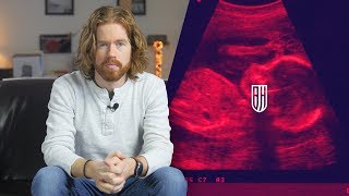 Answering the Pro-Choice Thought Experiment
