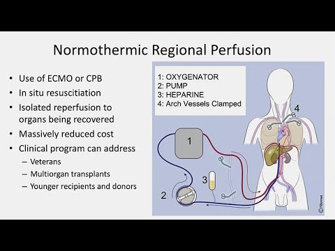 Donation after Circulatory Determination of Death in Heart Transplantation