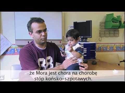 Koślawego płaskie stopy, którzy wyleczyć Guzek na palcu od uchwytu jako czyste