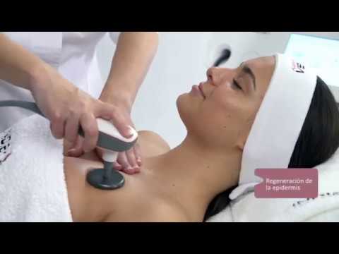 Tratamientos faciales INDIBA
