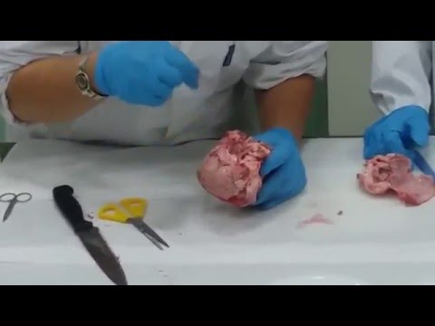 Sognare un verme Come liberarsi da parassiti in un corpo umano Elena Malysheva