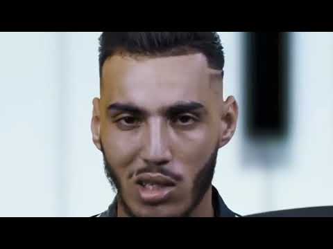 remix ( speed ) 21 tach x alousama , pharmacie  🔥🔥❤️