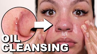 I Did OIL CLEANSING Every Day For One Week And This Is What Happened...