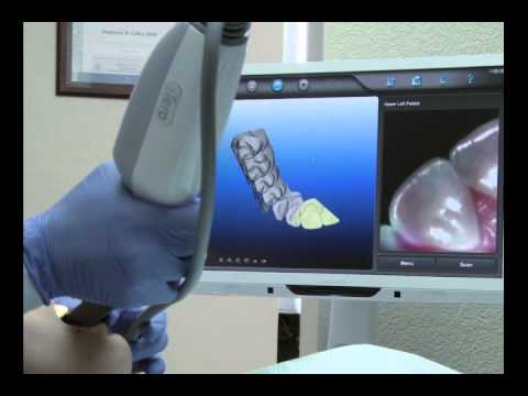 2 9 iTero patient video orthodontic   For PC Users