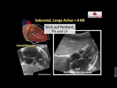 Essentials FEEL   Die Standardschnittebenen für den kurzen Blick auf das Herz....