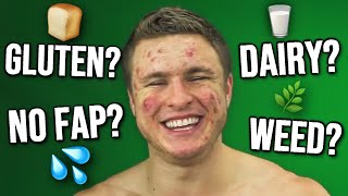 Does THIS Cause Acne | ULTIMATE LIST (VAPING, HOT SHOWERS, & MORE!)