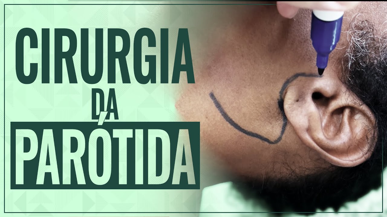 Cirurgia da Parótida - Tudo o que você precisa saber