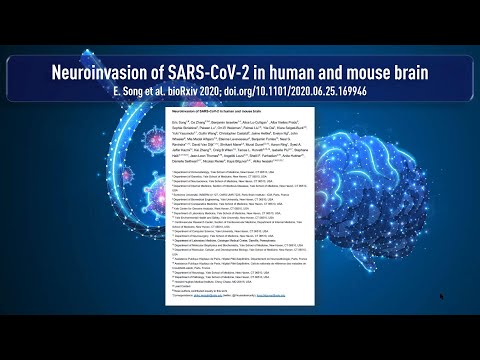 Studie: SARS-CoV-2 kann auch Gehirnzellen angreifen