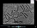 Real Microscopic Mitosis MRC