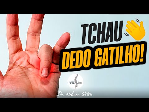 DEDO GATILHO - TRATAMENTO CASEIRO COM 4 EXERCÍCIOS Dr. Robson Sitta