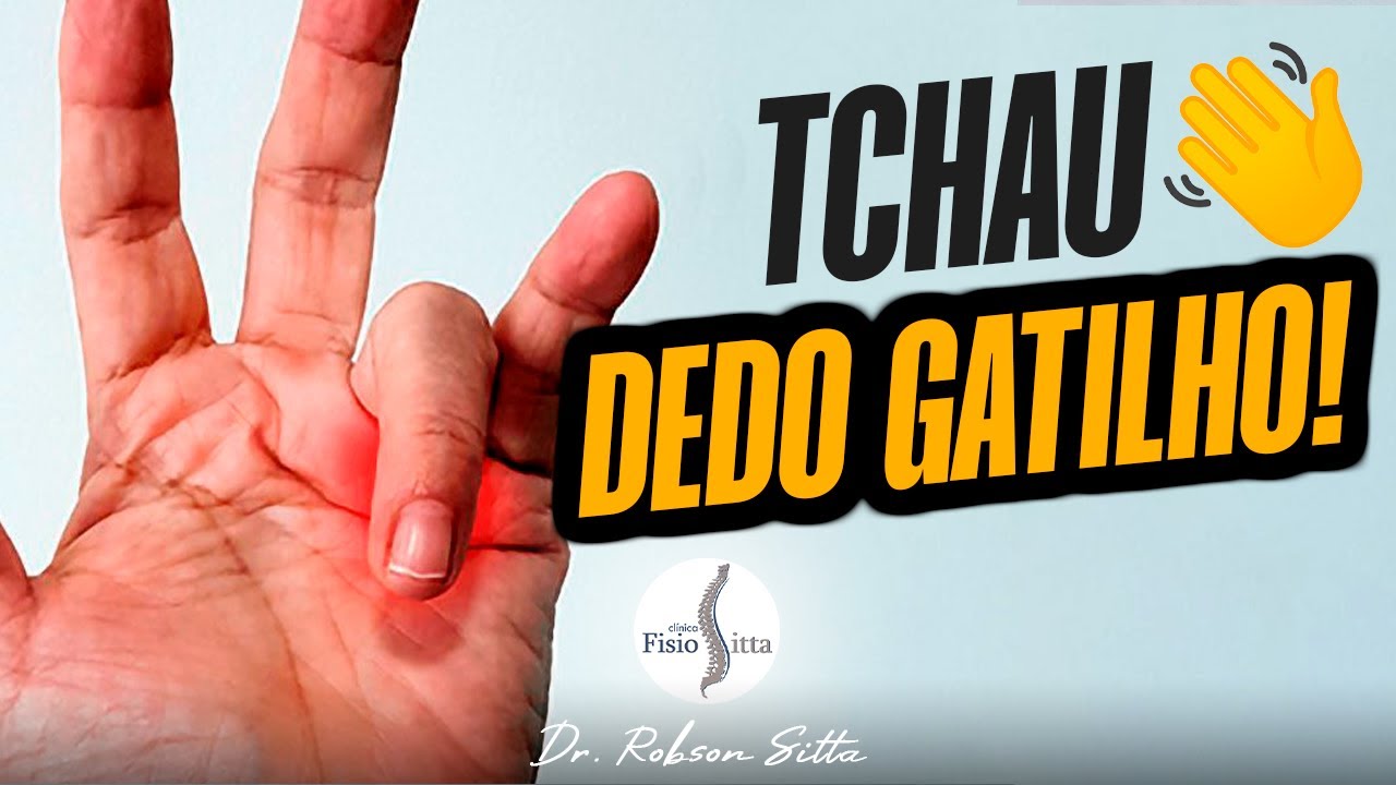 DEDO GATILHO - TRATAMENTO CASEIRO COM 4 EXERCÍCIOS Dr. Robson Sitta