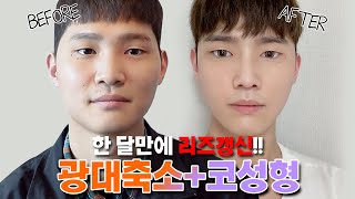 매일 동안 메이드영성형외과 – 미디어 매일 동안 메이드영성형외과 – 미디어