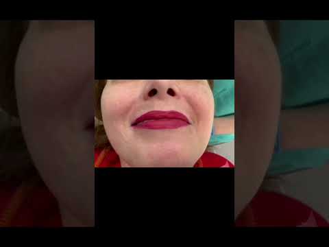 #smilecare #dentalimplants #zirconiumcrowns #smile